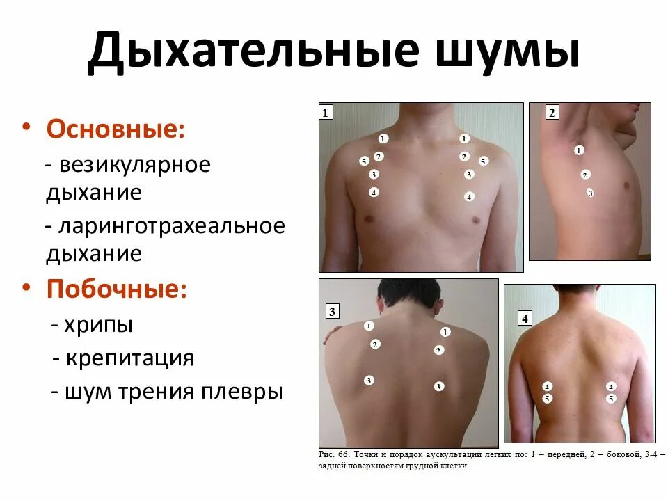 Аускультация везикулярного дыхания