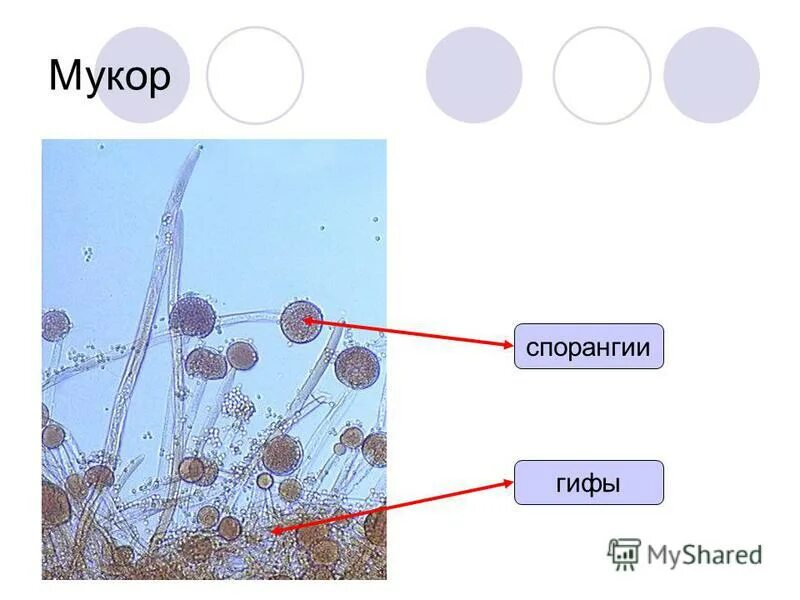 Мукор образует. Препарат мукора под микроскопом. Клетки гриба мукор под микроскопом. Строение гриба мукора под микроскопом. Мукор под микроскопом под микроскопом.
