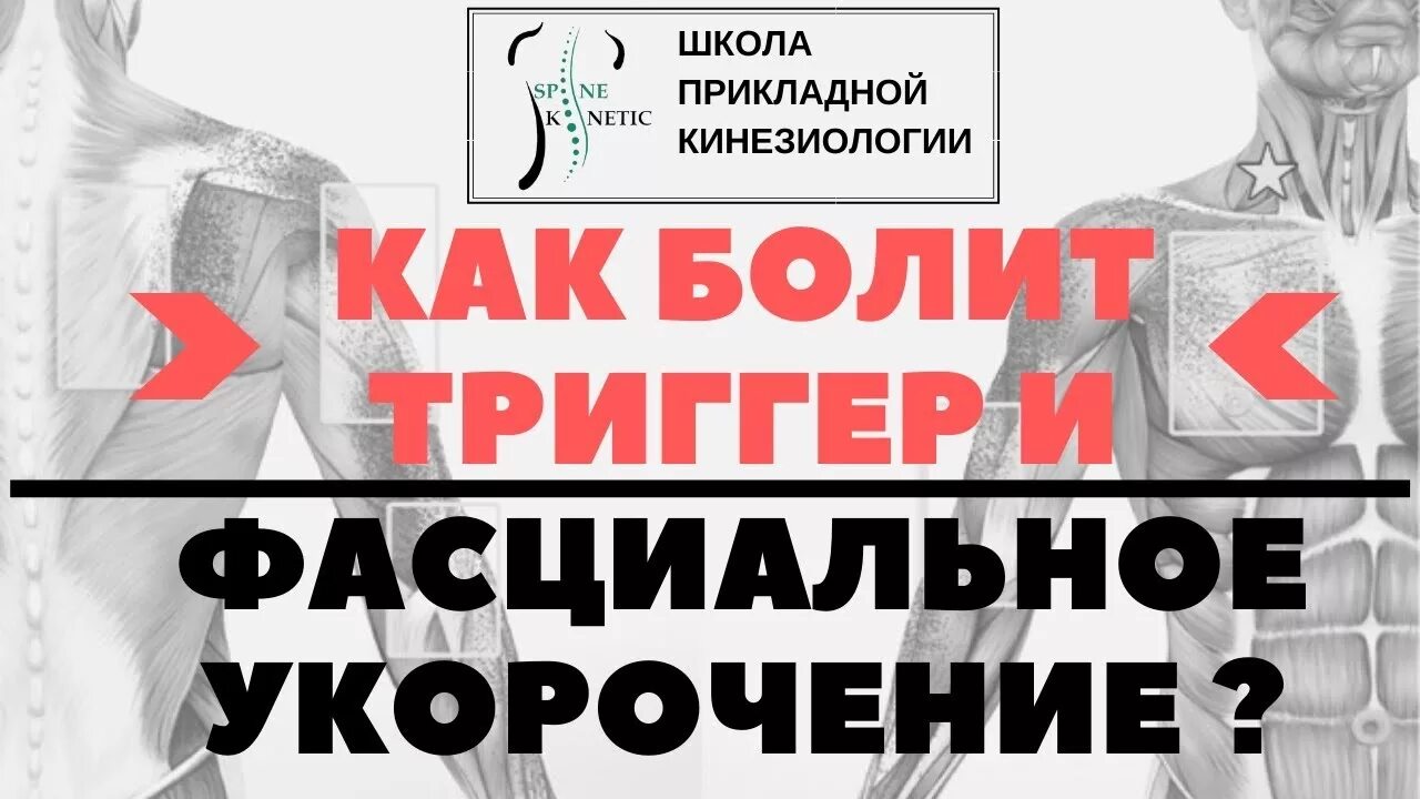 Как отличить мышечную боль. Как убрать мышечную боль. стекко фасциальная терапия. методика фасциальные манипуляции stecco. стефаниди а.в. - мышечно-фасциальная боль.pdf.
