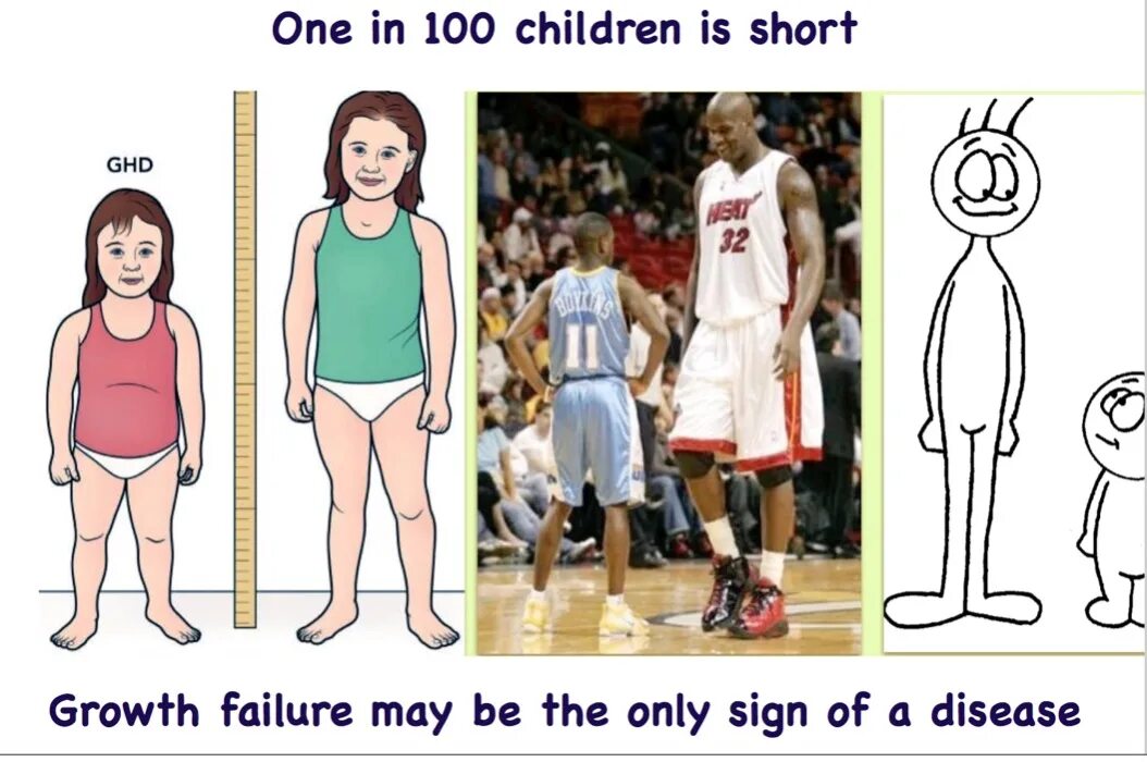 Small stature. Short stature. Height growth. Children height growth.