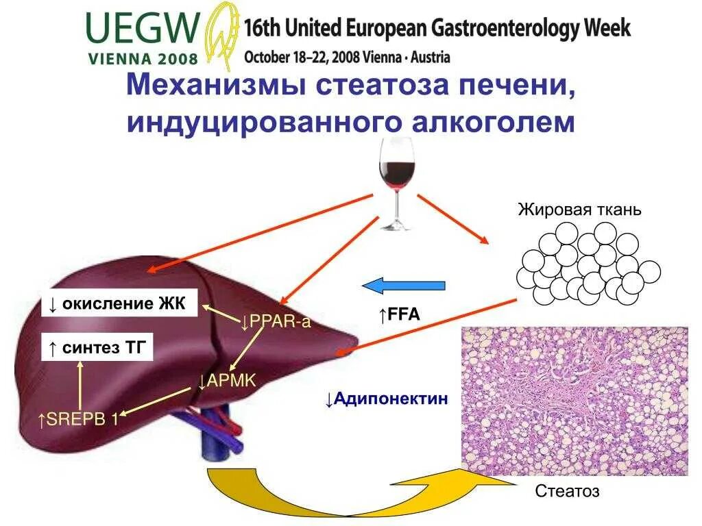 Механизм развития жирового перерождения печени. Патогенез жирового гепатоза печени. Механизм развития жировой дистрофии печени. Неалкогольный стеатоз печени патогенез. Гепатоз алкогольный лечение