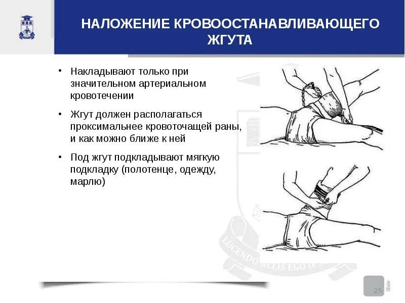 На какое время накладывают артериальный жгут. Наложение кровоостанавливающего жгута. Наложение восстанавливающего жгута. Техника наложения кровоостанавливающего жгута. Наложение жгута при артериальном кровотечении.