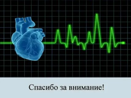 Нерегулярный пульс