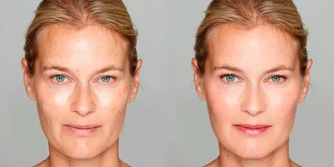 Потерял лицо что делать