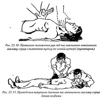 Как делать искусственное дыхание и массаж
