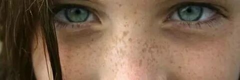 Цвет глаз пигментация