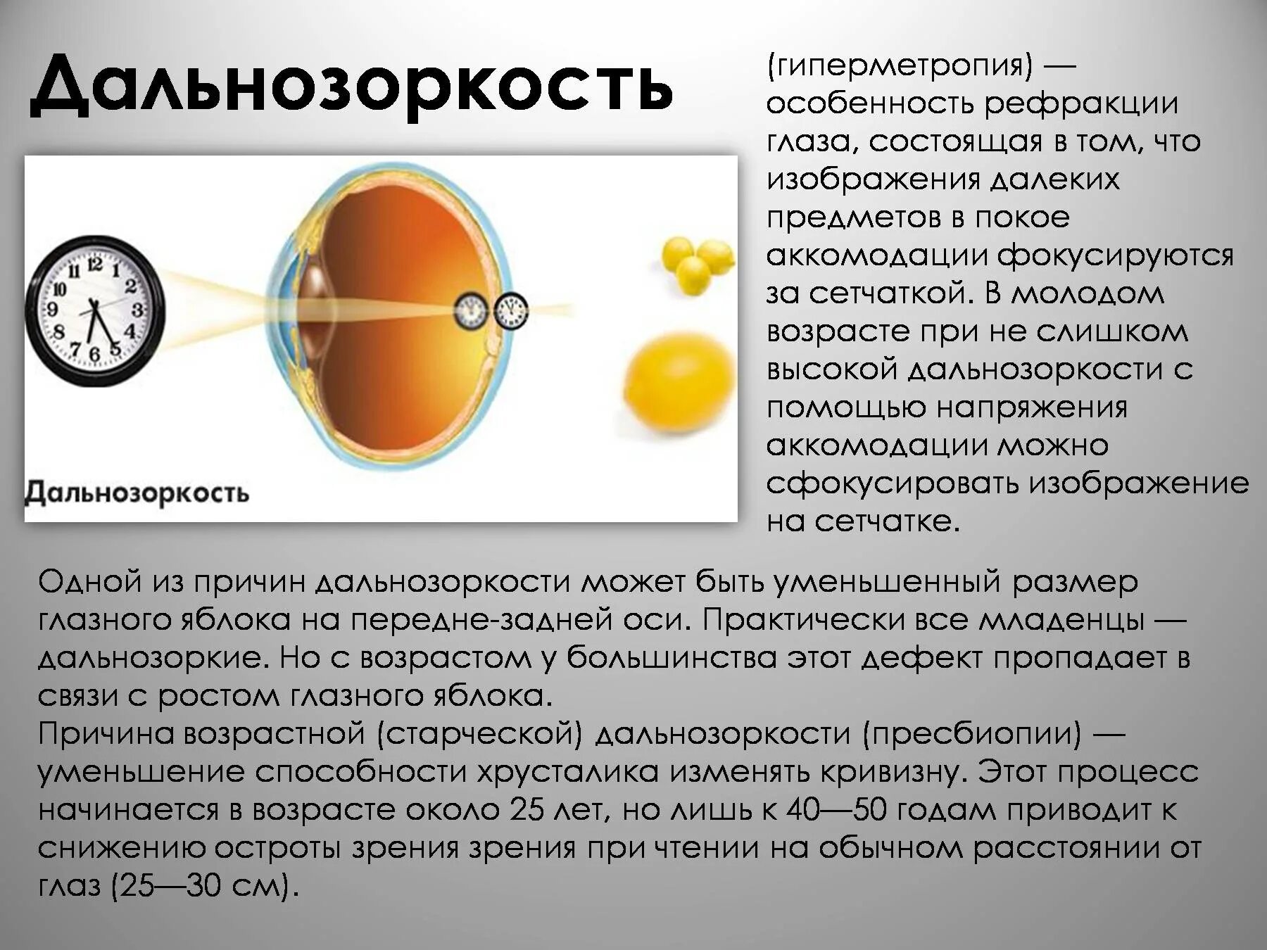 Почему у людей пожилого возраста развивается дальнозоркость. Пресбиопия (возрастная дальнозоркость). Дальнозоркость глазное яблоко. Рефракция гиперметропия глаза. Пресбиопия обоих глаз.