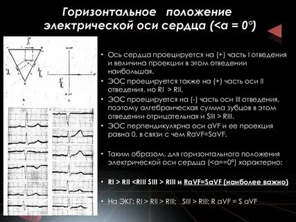 Эос улгау