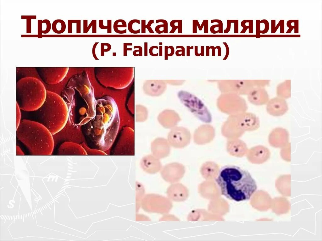 Малярийный плазмодий Тропическая малярия. Plasmodium falciparum трехдневная малярия. Малярийный плазмодий Plasmodium falciparum;. Малярийный плазмодий это бактерия. Лечение тяжелой тропической малярии