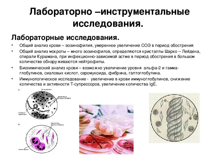 Анализ мокроты при астме. Спирали Куршмана и Кристаллы Шарко-Лейдена. Бронхиальная астма анализ мокроты спирали Куршмана. , Кристалл Шарко лейдамана, спирали Куршмана. Мокрота при бронхиальной астме.