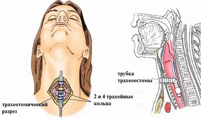 Пою на связках