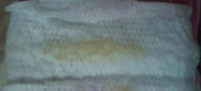 что выделяется у женщин во время