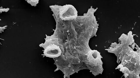 Амеба naegleria