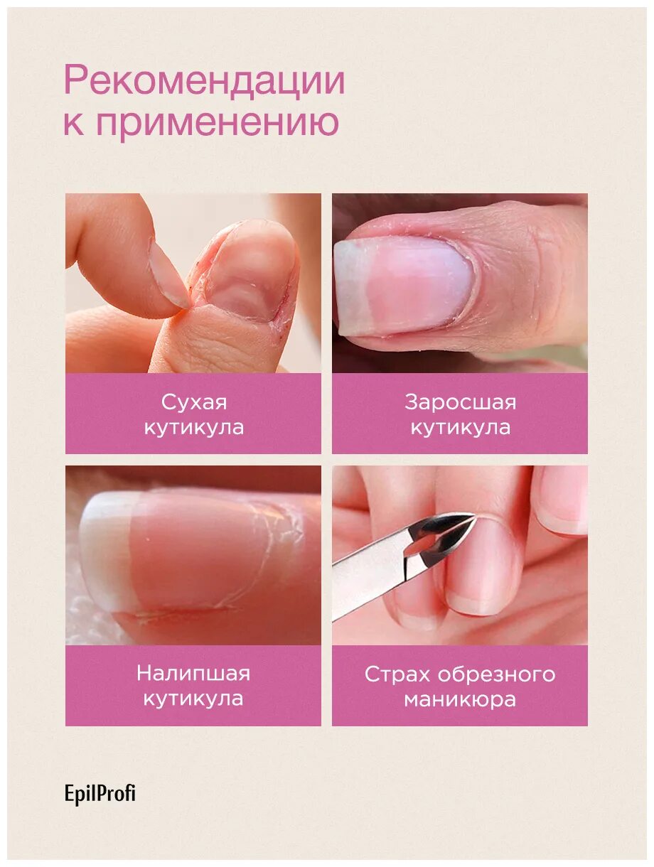 Гель-скатка для удаления кутикулы на руках epilprofi 30 мл. SOS Manicure гель скатка. Epilprofi SOS Manicure. SOS маникюр epilprofi.