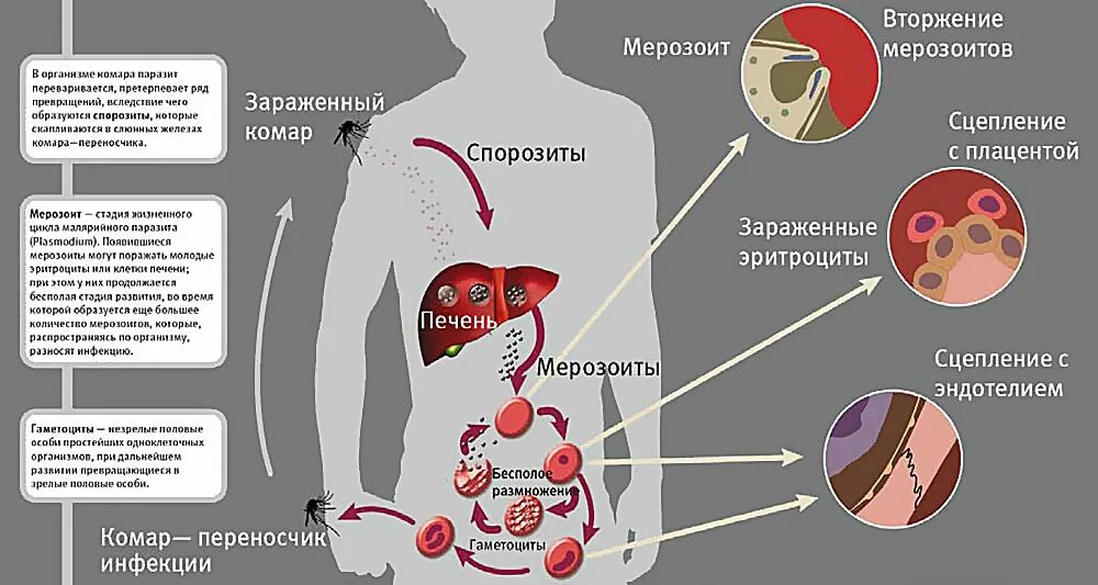 Заражение человека малярией происходит. Малярийный плазмодий это бактерия. Малярийный плазмодий заболевание. Симптомы болезни малярийного плазмодия. Симптомы заражения малярийного плазмодия.