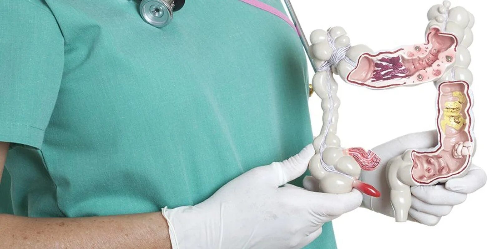 Аноскопия и ректороманоскопия что это. Как подготовиться к осмотру геморроя. Обследование у проктолога. Подготовка к визиту к проктологу. Как подготовиться к осмотру геморроя.