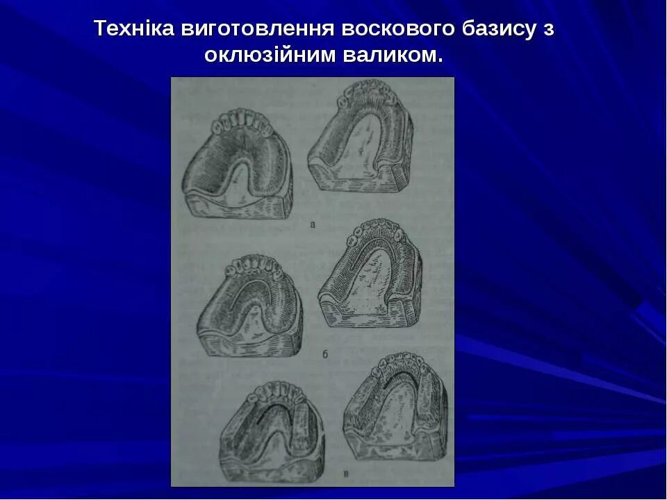 Линия базиса