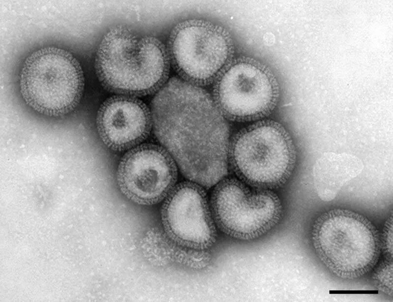 Вирус гриппа под. Вирус микроскопия коронавирус. Вирус гриппа электронная микроскопия. Вирус гриппа микрофотография. Вирус ОРВИ под микроскопом.