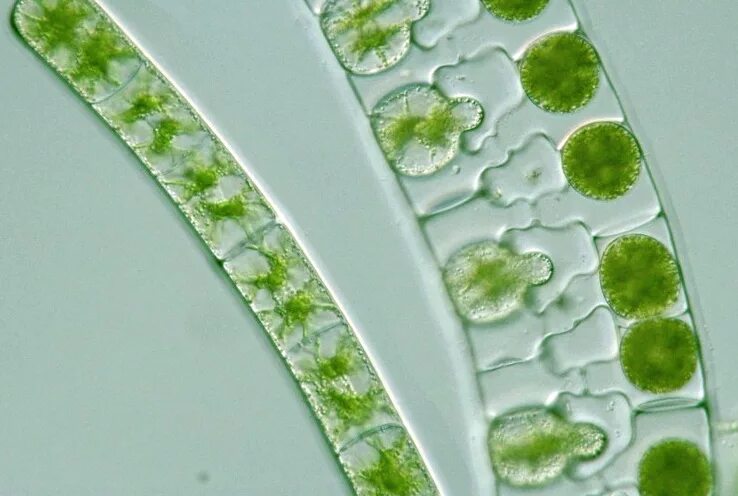 Зеленые водоросли форма. Зигнема водоросль. Зигнема конъюгация. Зигнема - Zygnema. Спирогира и зигнема.