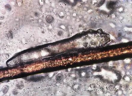 Demodex