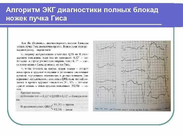 Алгоритм снятия экг ответы. Алгоритм снятия экг ответы