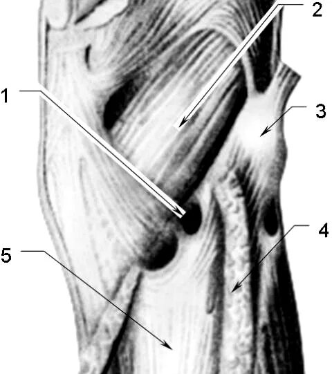 Canalis cruropopliteus анатомия. Canalis cruropopliteus стенки. Голеноподколенный канал (канал Грубера). Малоберцовый канал голени анатомия.