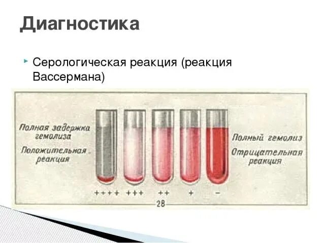 Сыворотка крови диагноз. Серологическое исследование крови на реакцию Вассермана. Реакция микропреципитации Вассермана. Реакция связывания комплемента Вассермана. Реакция связывания комплемента (реакция Вассермана) компоненты.