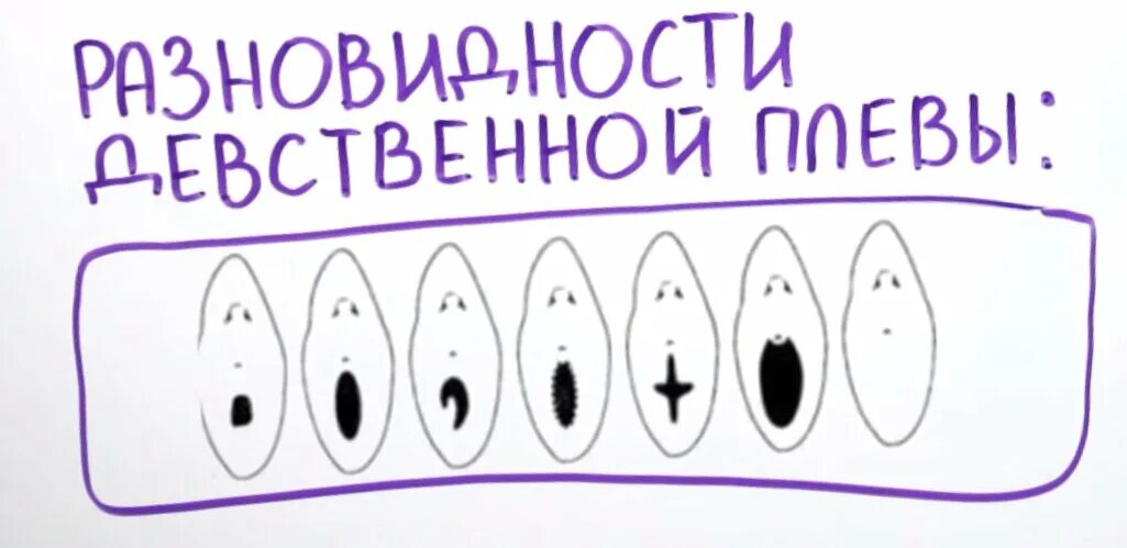 Как выглядит плева у детей Ultrasonography