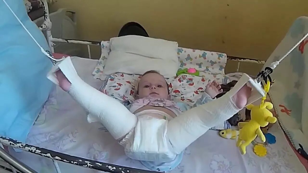 Электрофорез при дисплазии. Болезнь пертеса шина виленского. шина при дисплазии тбс. болезнь пертеса вытяжение.