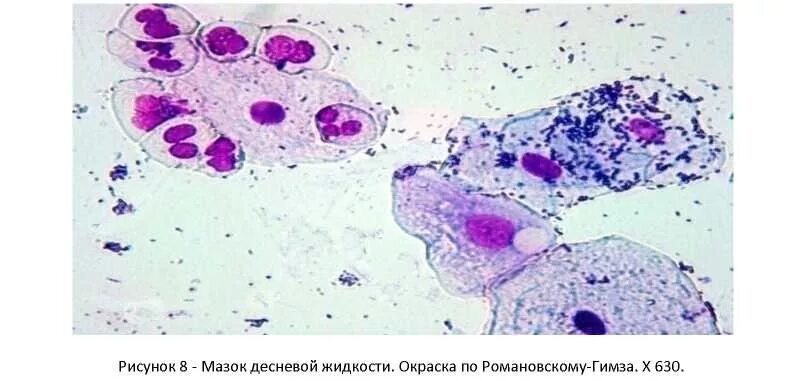 Романовский гимза окраска. Микоплазмы фазово контрастная микроскопия. Метод романовского. Метод романовского. Романовский гимза окраска.