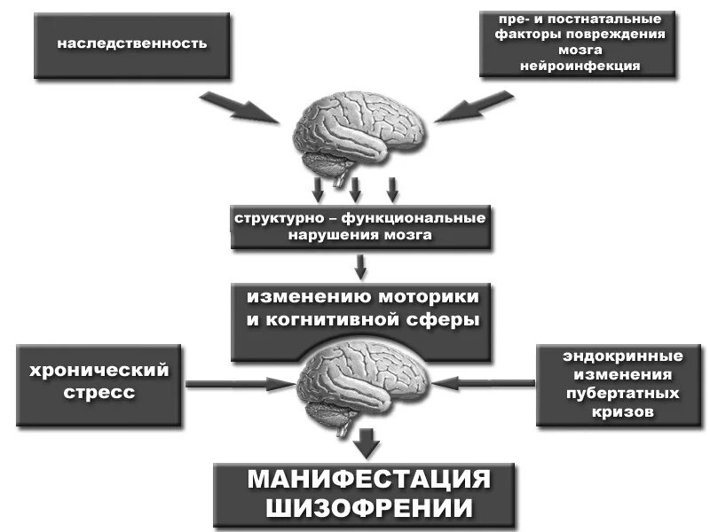 Причины развития шизофрении. Механизм развития шизофрении схема. Шизофрения патогенез схема. Манифестация шизофрении. Шизофрения дееспособный человек