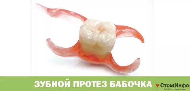 Зуб птичка. Зубной микропротез бабочка. временный микропротез бабочка на 2 зуба. бабочка микропротез на один зуб.
