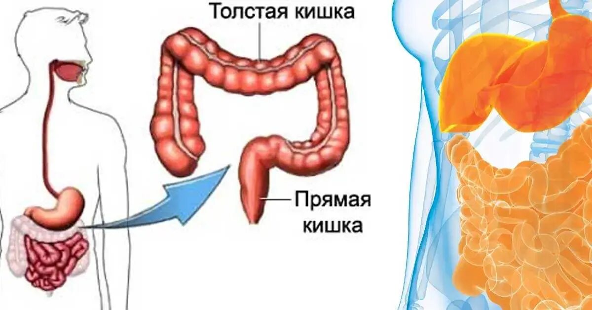 Разрыв толстой кишки симптомы. Повреждения Толстого кишечника симптомы.