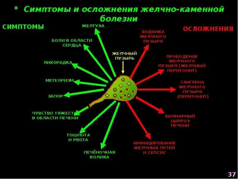 Основные симптомы ЖКБ. Осложнения желчнокаменной болезни. Желчнокаменная болезнь симптомы. Желчекаменная болезнь осложнения. Осложнения желчнокаменной