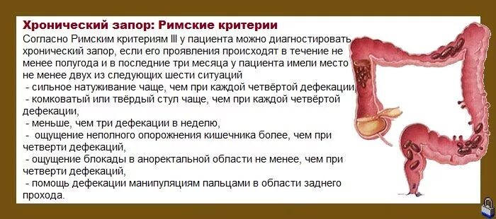 Боль при дефекации у мужчин причины. Хронический запор.