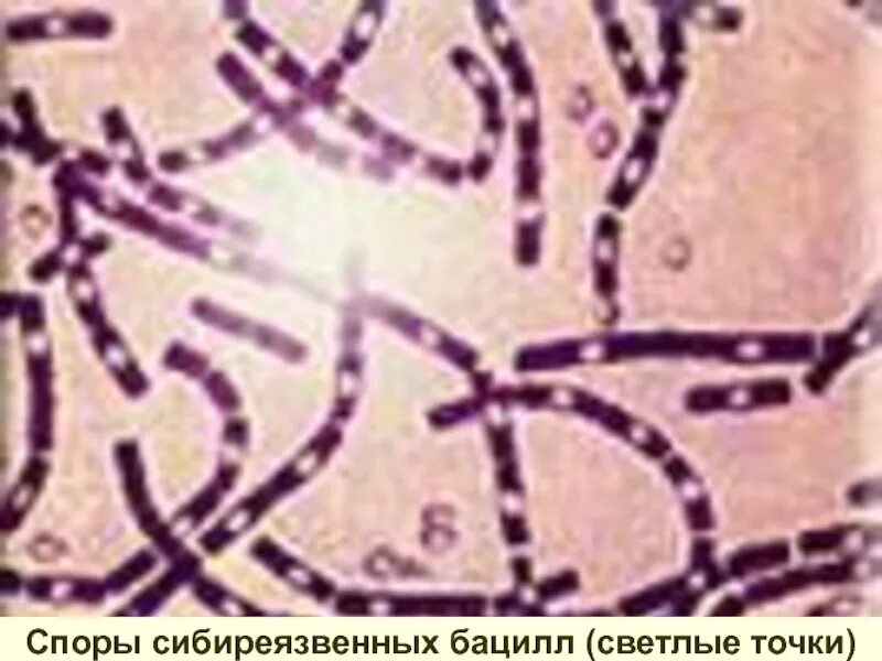 Окраска спор бактерий. Морфология бациллы сибирской язвы. Bacillus anthracis Сибирская язва. Бациллы сибирской язвы микроскопия. Сибиреязвенная бацилла микробиология.