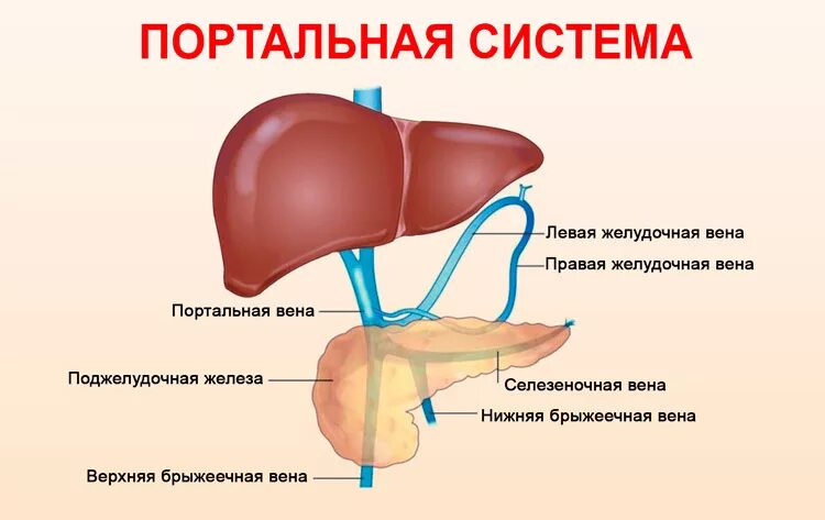 Система для печени. Портальная Вена при циррозе печени. Подпеченочная портальная гипертензия. Синдром портальной гипертензии печени. Гипертензия портальная к76.6.