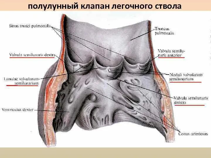 Клапан легочного ствола сердца. Полулунный клапан легочного ствола. клапан легочного ствола анатомия. синус легочного ствола. створки клапана легочного ствола.