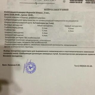 Узи головы 1 месяц