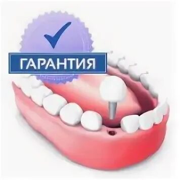 Гарантия на импланты