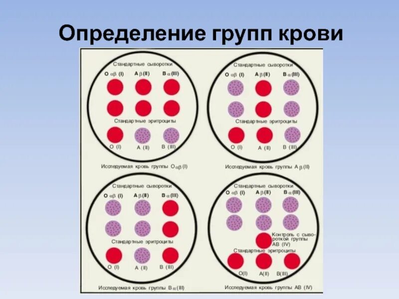 Как определить 4 группу крови. Определение группы крови методом агглютинации. Определить нруппумкрови. Ака определить группу крови. Белки определяющие группу крови