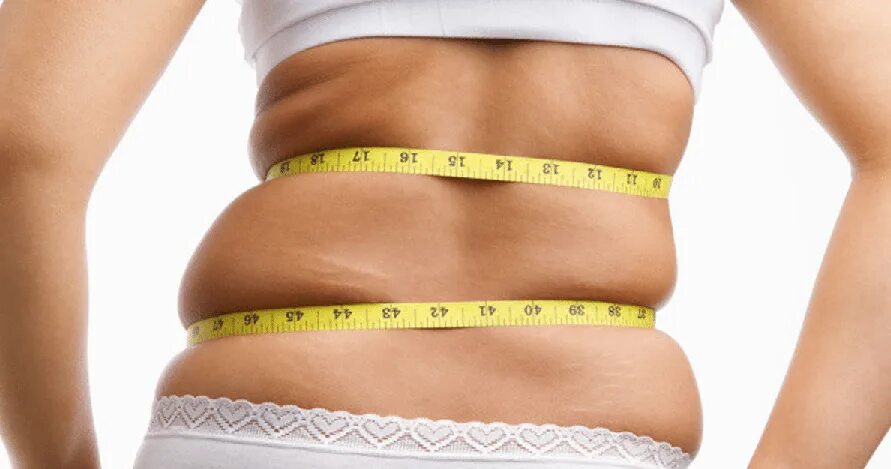 Body develop. Жировые складки на боках. Липосакция жира со спины. Жировые складки на животе у женщин.