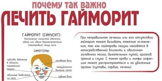 Синусит без насморка и температуры симптомы