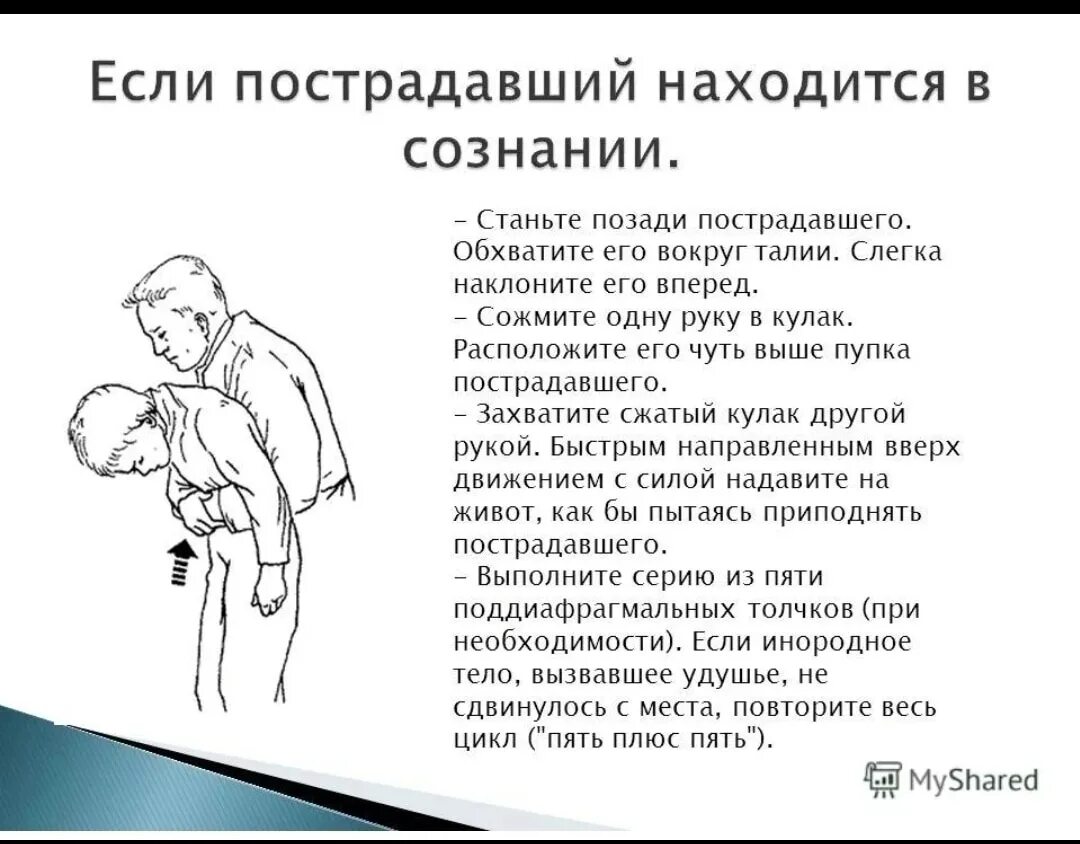 Обструкция дыхательных путей инородным телом первая помощь. Подавился метод Геймлиха. Техника проведения приема Геймлиха. Манёвры Геймлиха.