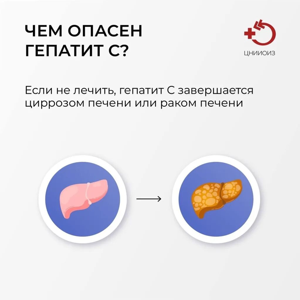 Что такое гепатит как лечиться. Профилактика гепатита. гепатит c. профилактика хронического вирусного гепатита.