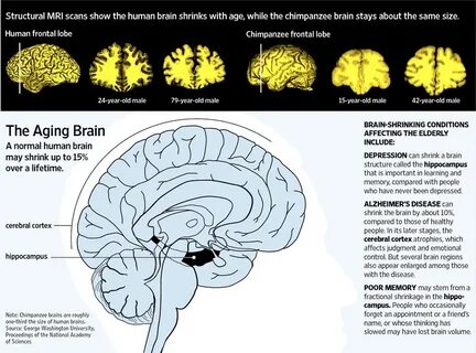 Brain am