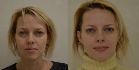 Скульптурное лицо отзывы