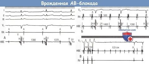 Блокада после операции
