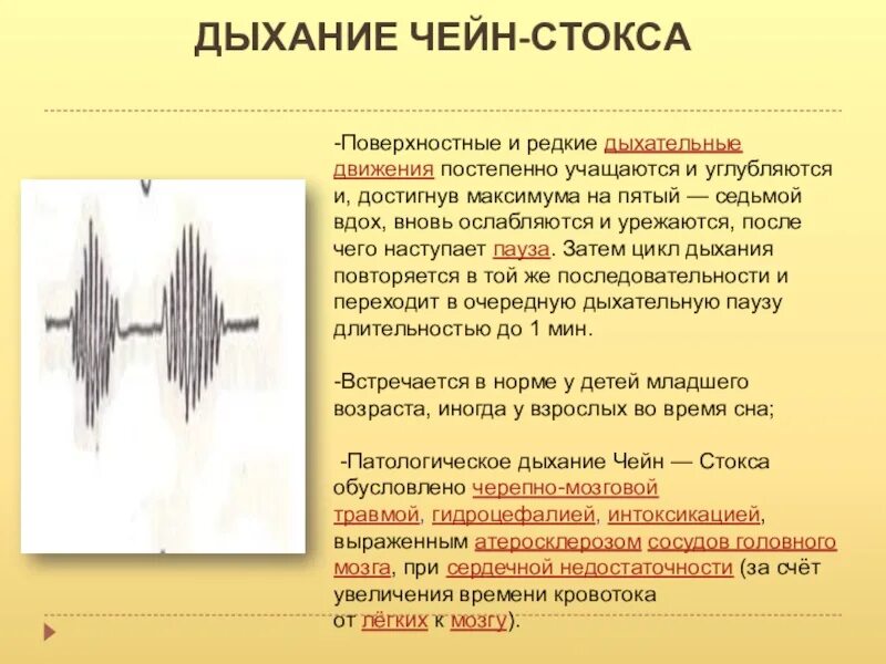 1 редкое дыхание. Дыхание по типу Чейна Стокса. Чейн Стокса возникает при. Дыхание Чейна Стокса. Дыхание Чейна-Стокса характеризуется.