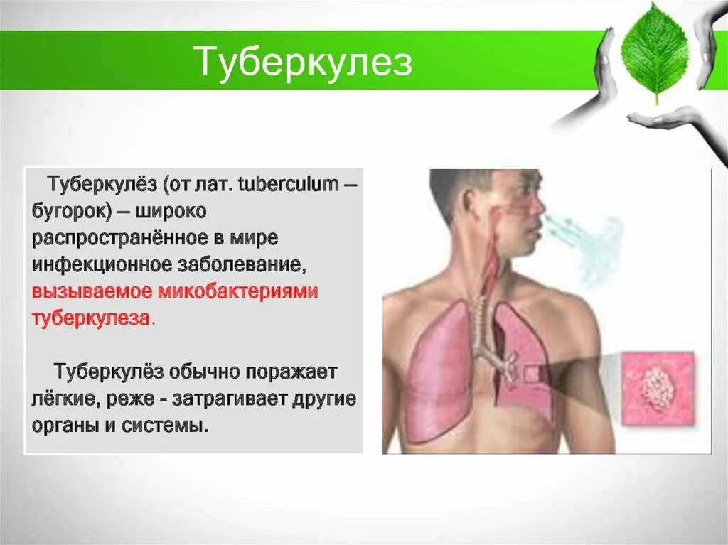 Tuberkulyoza. Туберкулез образ жизни